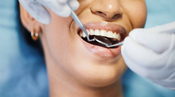 Best Emergency Wisdom Teeth Removal in Hartville, OH